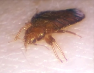 Bed Bug Feeding on Arm